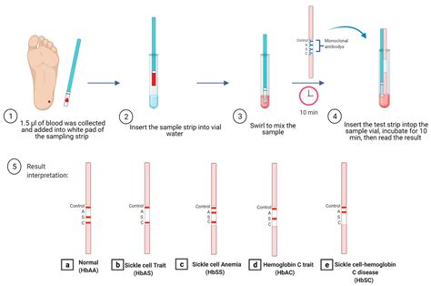 lightest drop test chainmail sca|Techniques for the Detection of Sickle Cell Disease: A Review.